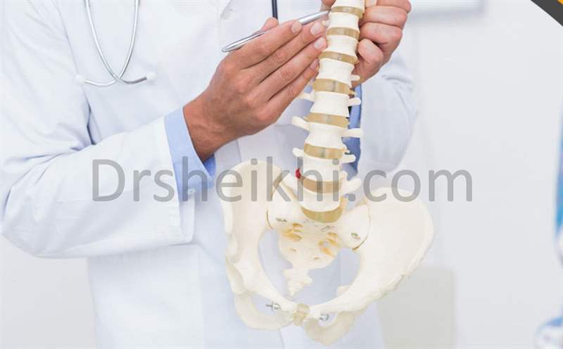 جراحی دیسک کمر توسط جراح ستون فقرات