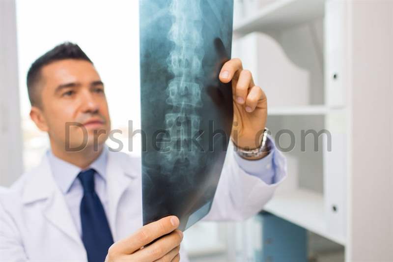 جراح دیسک گردن و جراح ستون فقرات