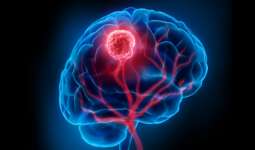 مهمترین دلایل و علت بوجود آمدن تومور مغزی
